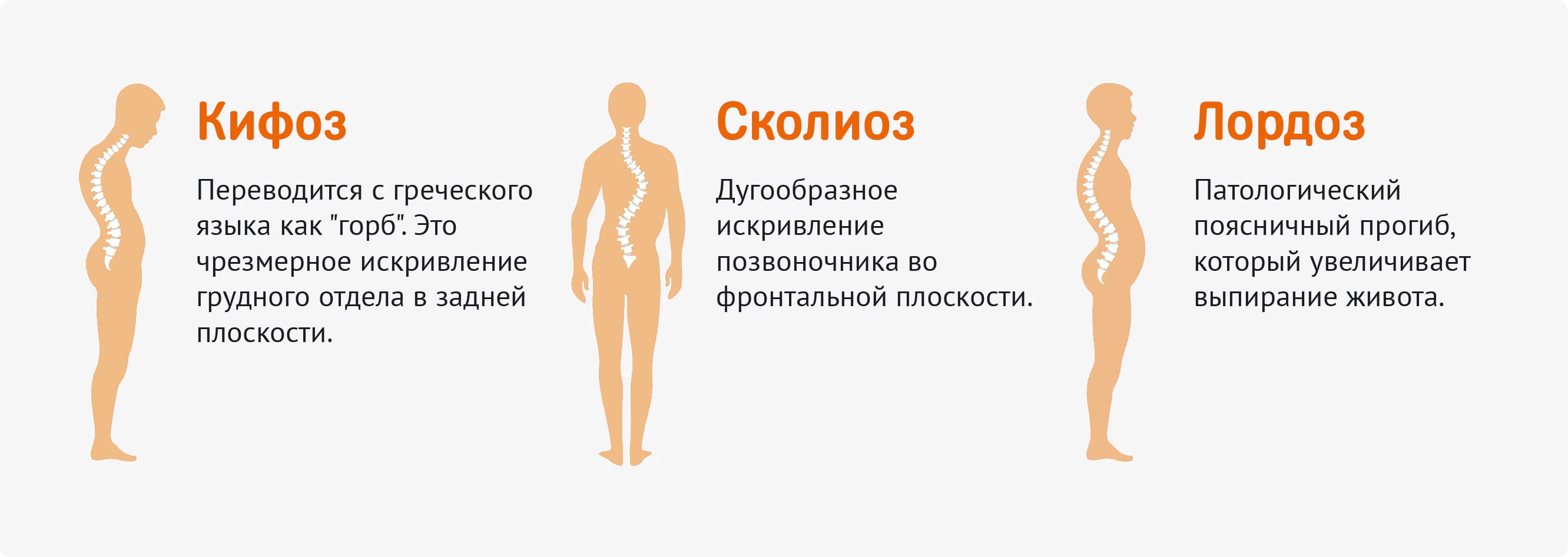 Исправляем сколиоз в домашних условиях Исправляем сколиоз в домашних условиях